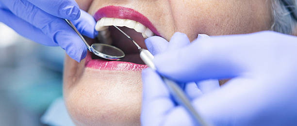 Best Emergency Cosmetic Dentistry (e.g., broken veneers) in Grape Creek, TX
