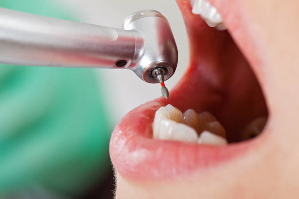 Best Emergency Treatment for Oral Infections in Grape Creek, TX